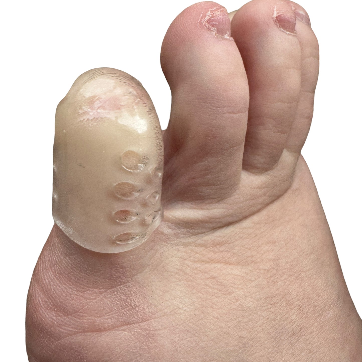 Silicone Toe or Finger Protector